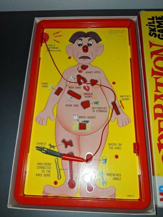 Vintage 1965 Operation Board Skill Game by Milton Bradley 2