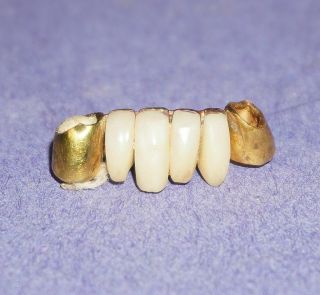 Antique Denture Gold Teeth,  Vintage Gold Scrap