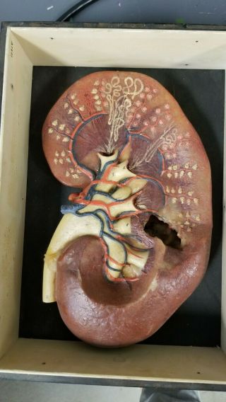Antique,  Hand Painted Wax Anatomical Model (kidney)