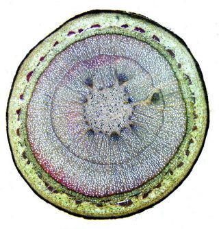 Vintage Microscope Slide By K.  Mattinson.  " Stem Of Apple Tree ".  2 Years Old.