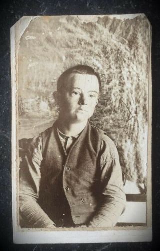 Antique Victorian Carte De Visite Photo Of A Boy With Down Syndrome
