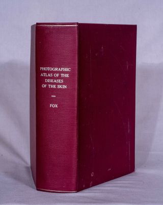 Photographic Atlas Of Diseases Of The Skin By Fox 1903 Physicians 