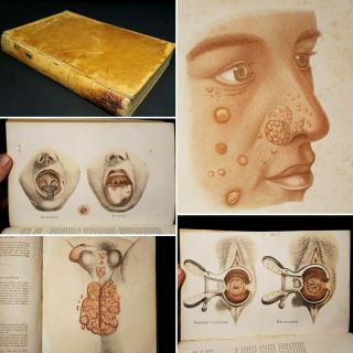 1858 Medical Treatise On Diseases Urinary Organs Acton Scarce Coloured Plates