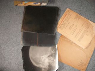 Rare Antique Medical Ww2 German Post War Medical Papers And Human X - Rays