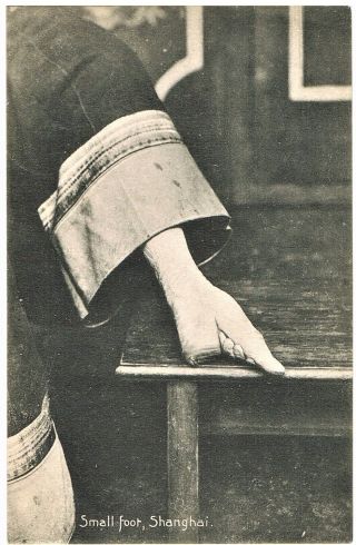 Lily Foot.  Foot Binding In China.  Vintage Postcard