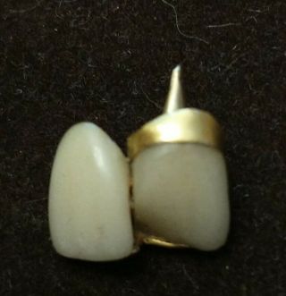 Vintage 2 Gold Human Tooth Partial Cap Crown Dental Scrap