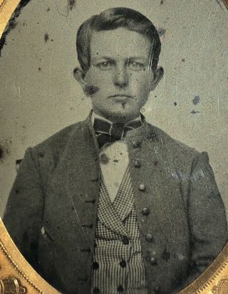 Ambrotype,  Civil War Theme,  Serious Young Boy Wearing Coat With Various Buttons