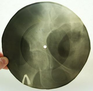 X - Ray 78rpm 8 " Doris Day Shanghai Rare Ussr Roentgen Bones Pelvis Coccyx 1950s
